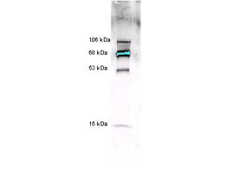 Anti-Myeloperoxidase, human white blood cell (MPO, pANCA)