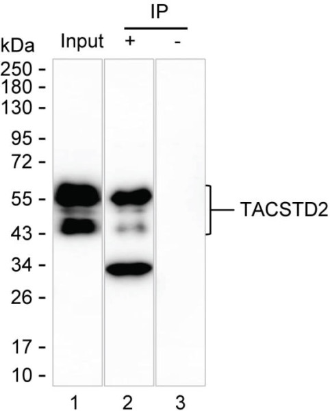 Anti-TACSTD2