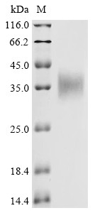 Erythropoietin (EPO), Macaca fascicularis, recombinant