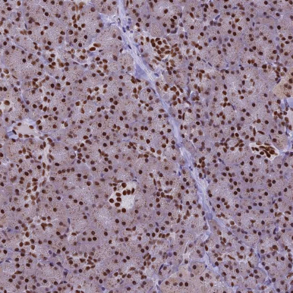 Anti-IRF2BP1