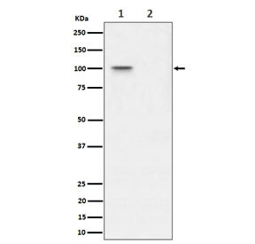 Anti-Phosphorylated-Nucleolin (pT76), clone 29N32
