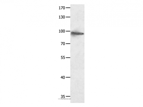 Anti-HCN1