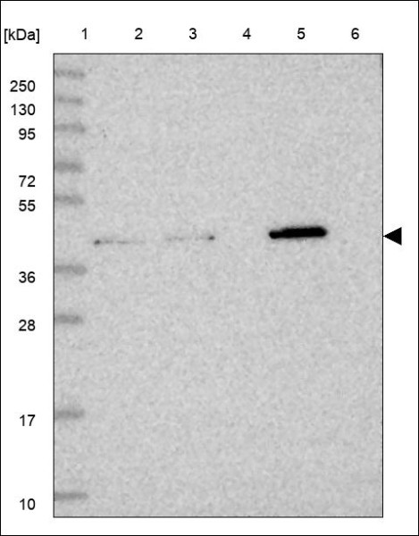 Anti-ZDHHC11