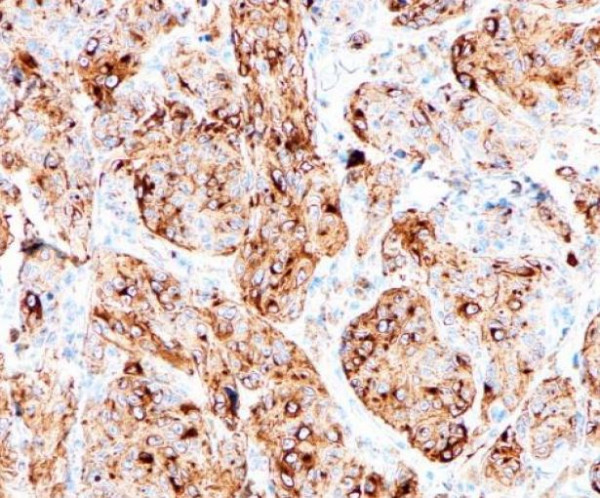 Anti-Silver homologue / Pmel 17, clone SQab1738