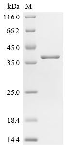 Charged multivesicular body protein 2b (CHMP2B), recombinant human