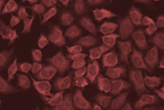 Anti-CD79a