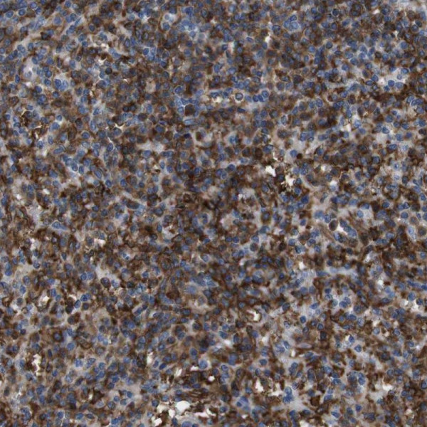 Anti-CD300C