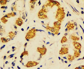 Anti-OXCT1