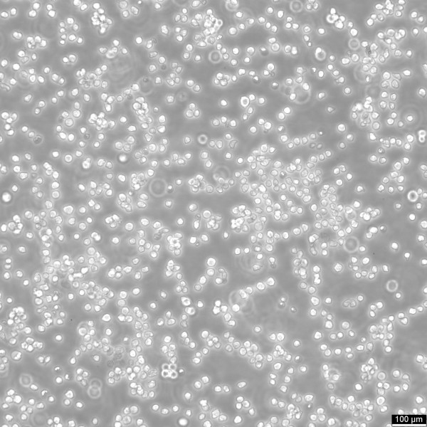 Nalm-6 Cells