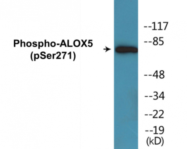 ALOX5 (Phospho-Ser271) Colorimetric Cell-Based ELISA Kit