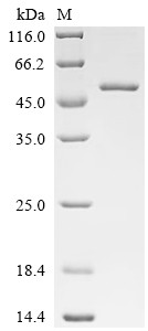 Glutathione peroxidase 3 (GPX3) (U73C), human, recombinant