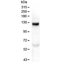 Anti-Collagen XVII antibody / COL17A1