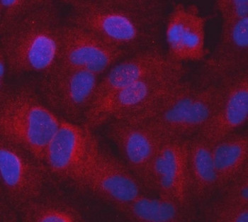 Anti-SARS1 / Seryl-tRNA synthetase / SERS