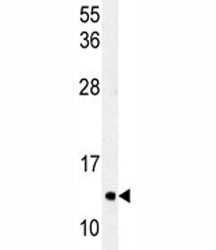 Anti-LC3C