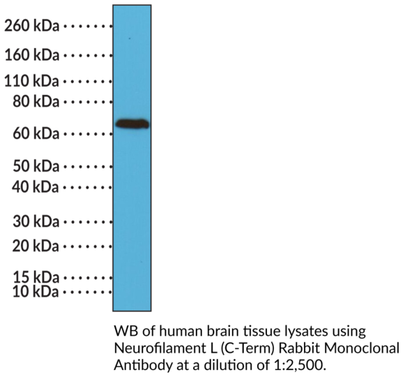 Anti-Neurofilament L (C-Term) Rabbit Monoclonal Antibody (Clone RM280)