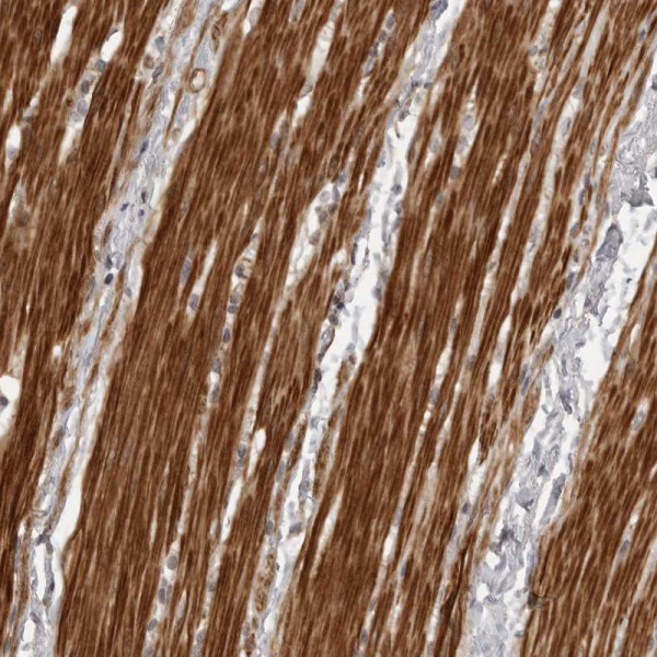 Anti-ZCCHC11