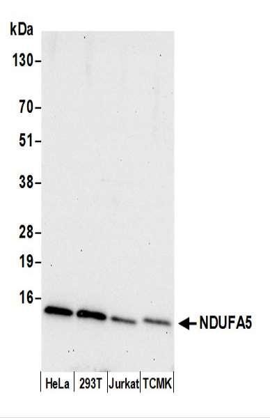 Anti-NDUFA5