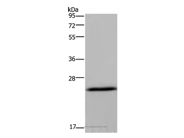 Anti-KCNMB4