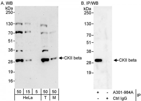 Anti-CKII beta