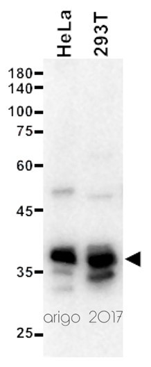 Anti-Protein Phosphatase 4C, clone 2F11-D10-G4