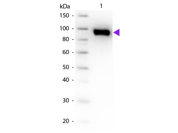 Anti-PLASMINOGEN (Human Plasma)