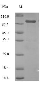 Steroid 17-alpha-hydroxylase/17,20 lyase (CYP17A1), human, recombinant