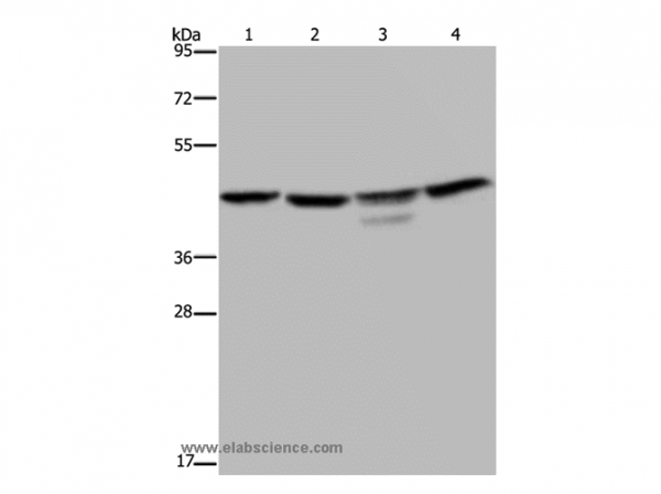 Anti-CSNK2A1