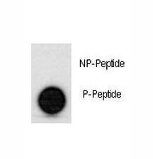 Anti-phospho-p53 (Ser315)