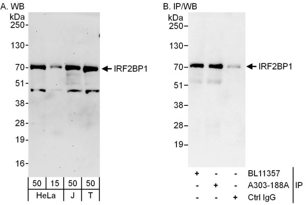 Anti-IRF2BP1