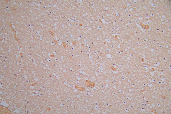Anti-DPYSL2, recombinant clone 1A1