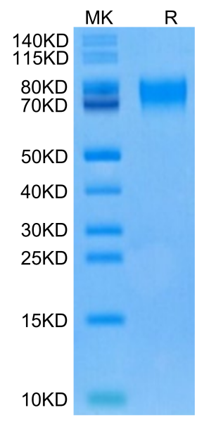 Human CD6 Protein