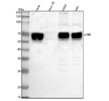 Anti-LTBR / Lymphotoxin-beta receptor