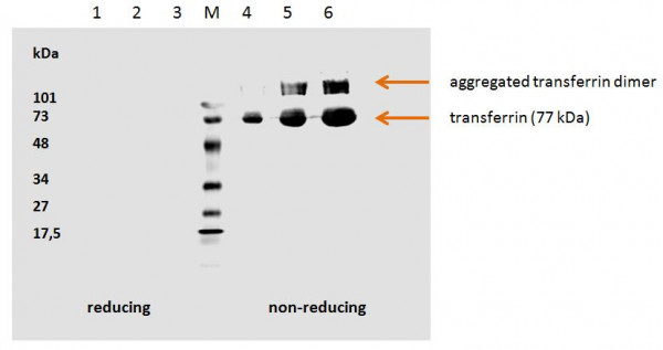Anti-Transferrin, clone HTF-14
