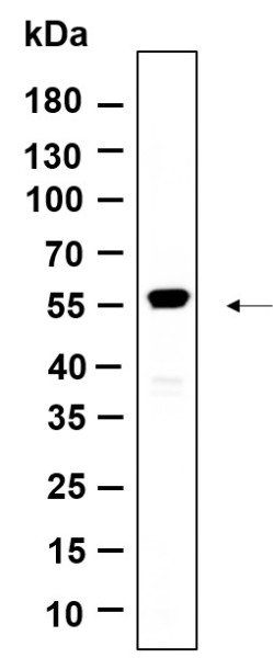 Anti-Recombinant Krs-2, clone 9D2