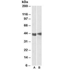 Anti-CD123