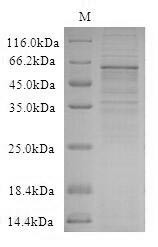 Protein Wnt-2b (WNT2B), human, recombinant