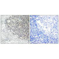 Anti-COL9A3