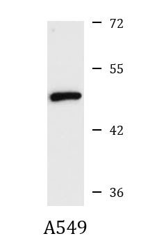 Anti-SGCA / alpha Sarcoglycan