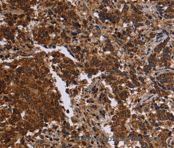 Anti-FMN2
