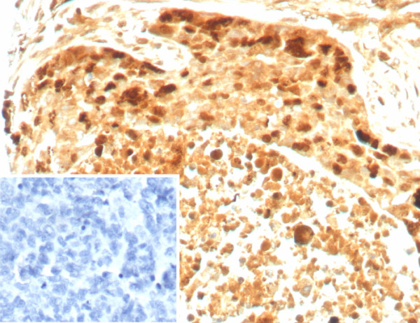 Anti-Survivin / BIRC5, recombinant antibody, clone BIRC5/8936R