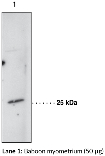 Anti-Prostaglandin D Synthase (hematopoietic-type)