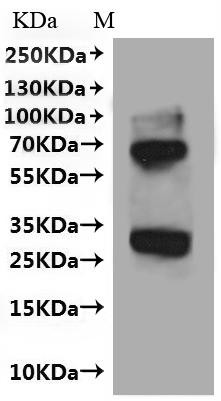 Very-long-chain enoyl-CoA reductase (TECR), human, recombinant
