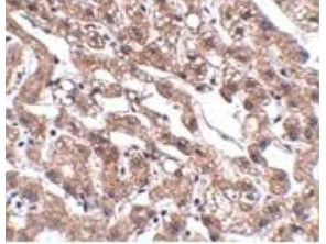 Anti-MACC1 (Metastasis associated in colon cancer 1)