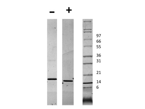 CD40 Ligand