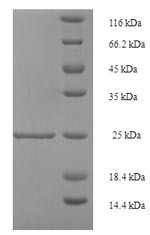 Resistin (RETN), human, recombinant
