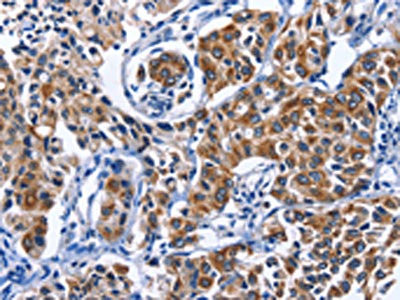 Anti-MYH1