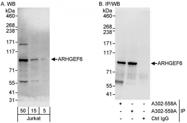 Anti-ARHGEF6