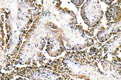 Anti-CLN1