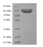 Pyruvate kinase isozymes R/L (Pklr), rat, recombinant