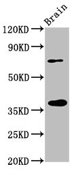 Anti-EIF3I